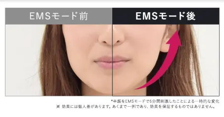 ボーテ・マルティのEMSモード使用前、使用後の女性の頬の写真