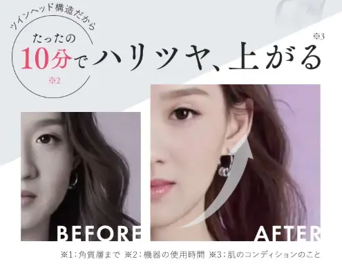 ボーテ・ヤヌスを10分間施術したビフォーアフターの女性の顔写真