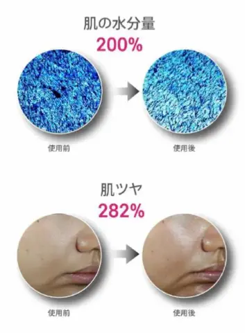 使用前使用後の肌改善効果の比較写真