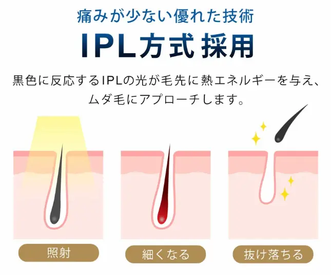 IPL方式の説明の図