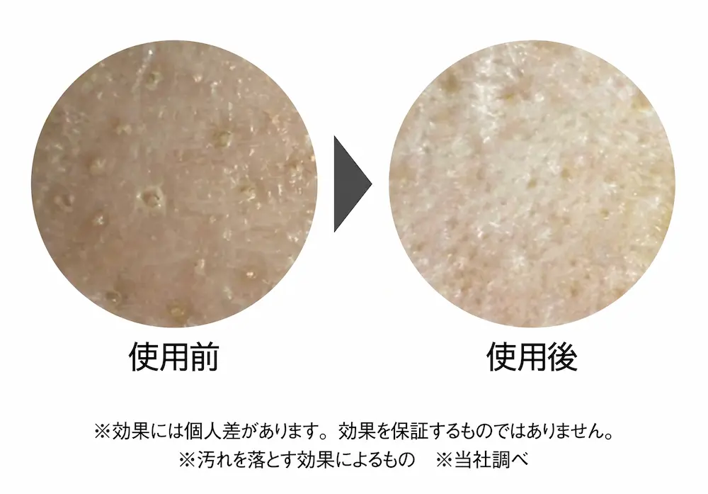 コモエース ディープクレンジングオイル使用前使用後の肌表面の比較写真